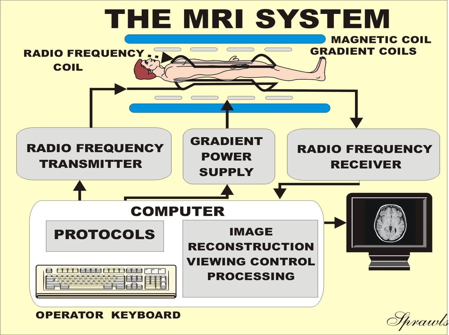 MRI scanner