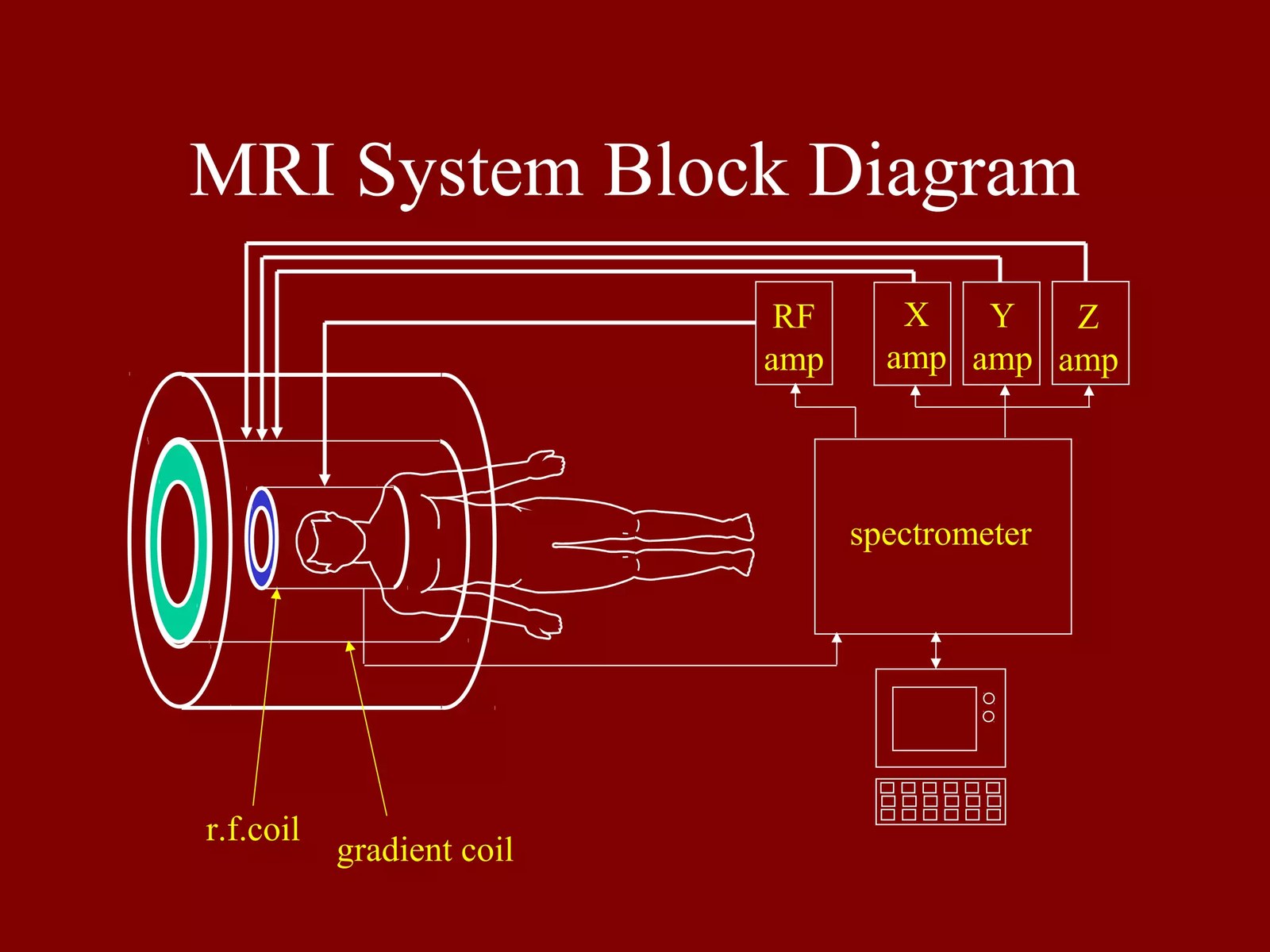 MRI scanner